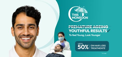 hair loss offer cost section