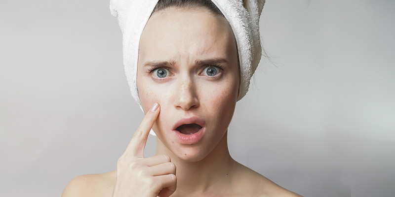 Pimple-Treatment-In-Hyderabad