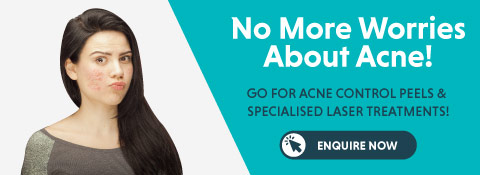 Book An Appointment For Acne Treatment Book An Appointment For Acne Treatment