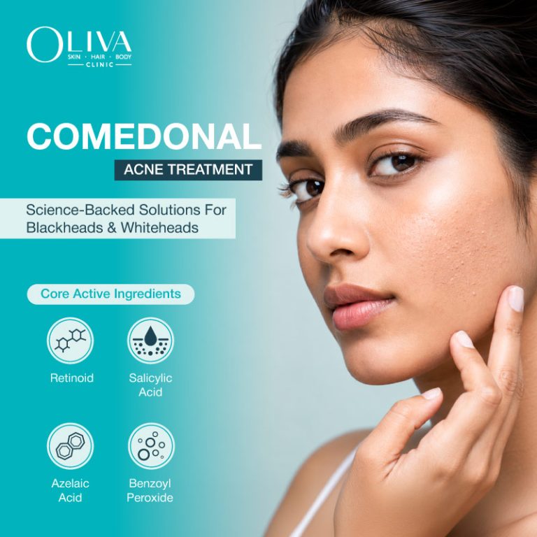 comedonal acne treatment