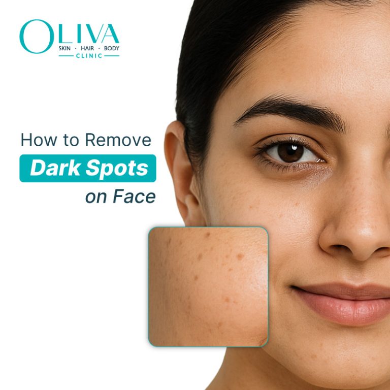 Black Dark Spots On Face