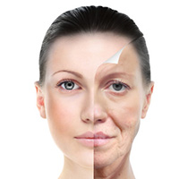 ডার্মাল ফিলেরস ট্রিটমেন্ট(Fillers)