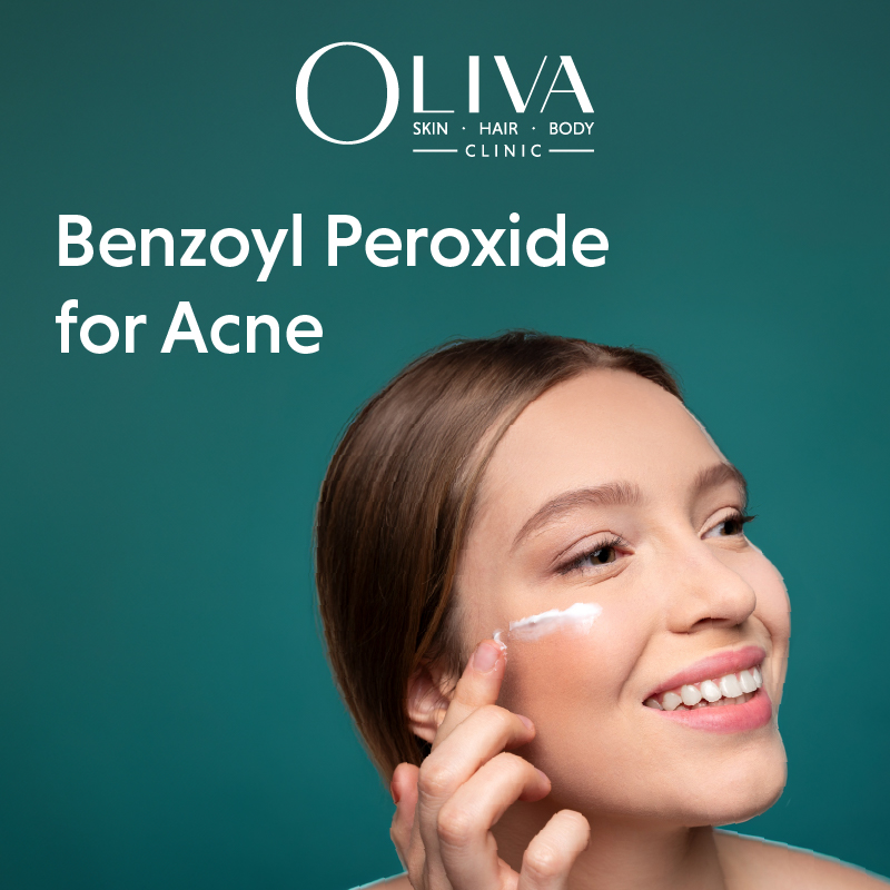 Benzoyl-Peroxide-For-Acne