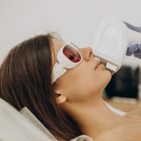 laser hair removal on face