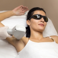 underarm laser hair removal