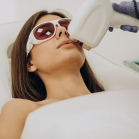 upper lip laser hair removal