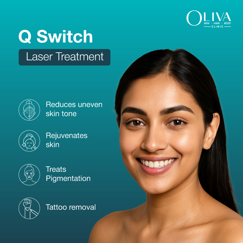q switch laser