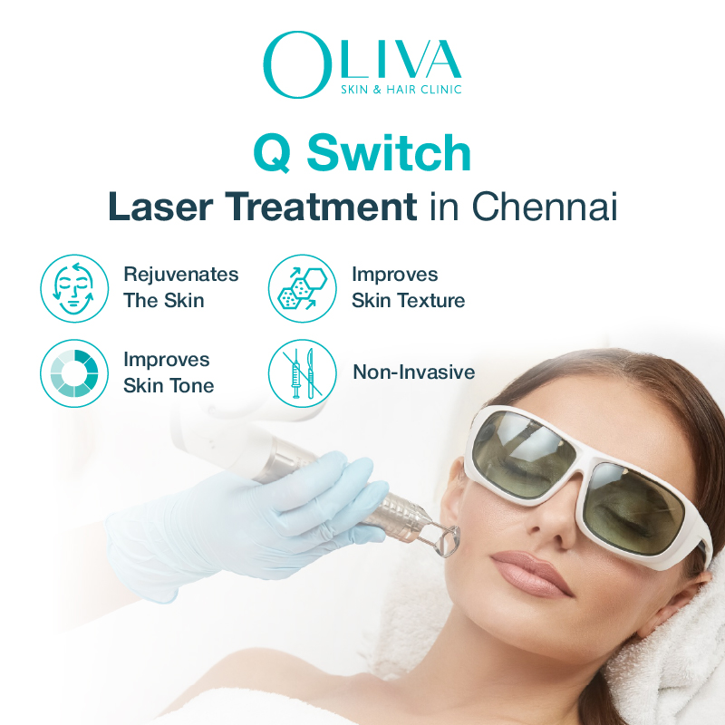q switch laser treatment in chennai