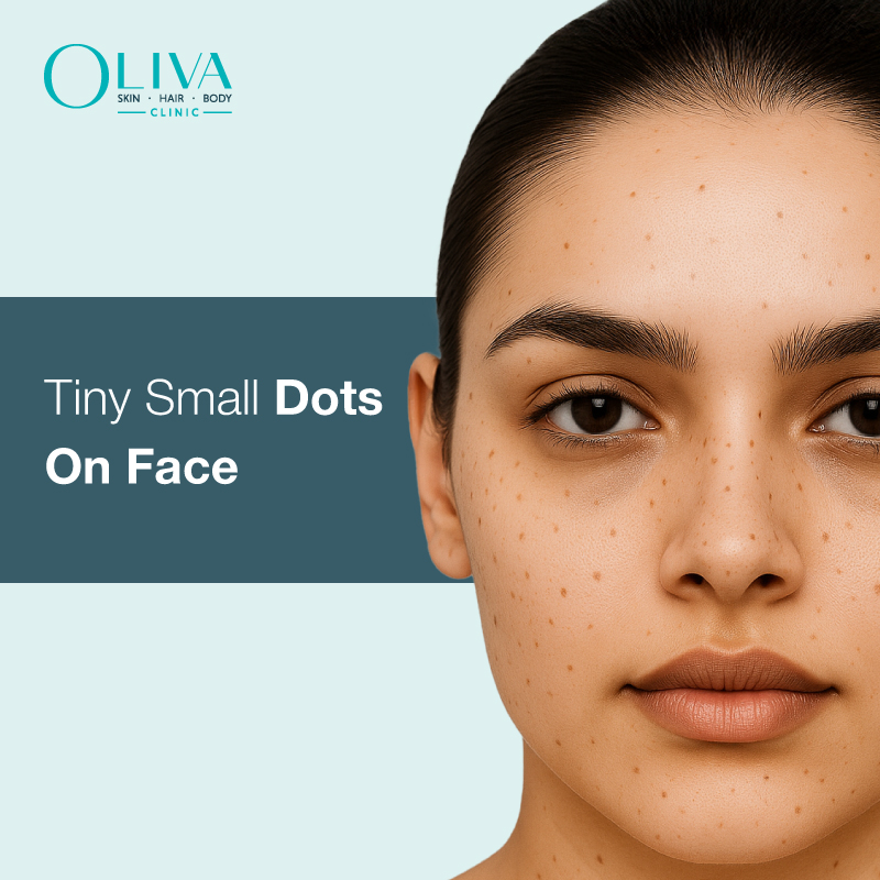 Tiny Black Dots On Face