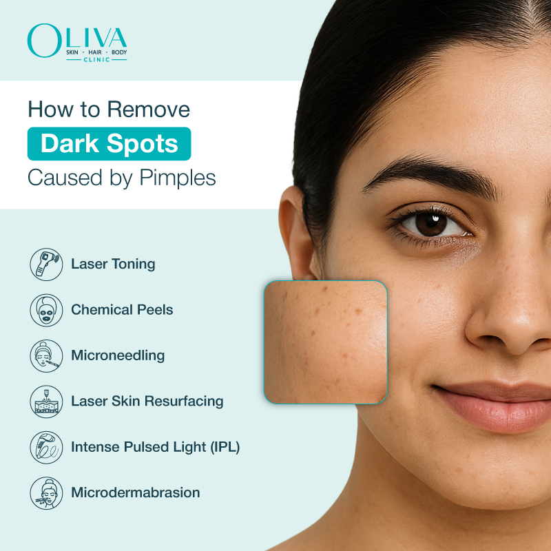 how to remove dark spots caused by pimples