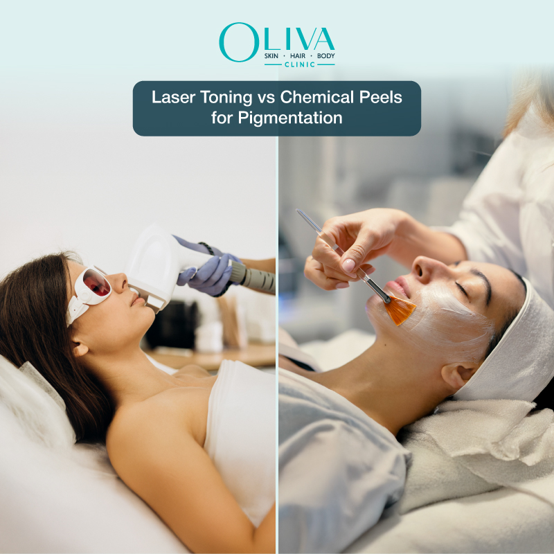 laser toning vs chemical peel for pigmentation