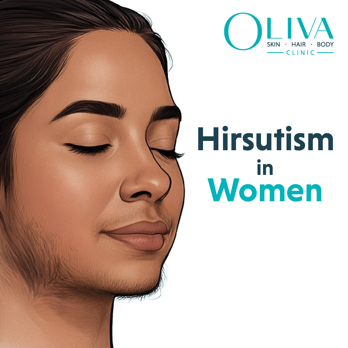 Hirsutism in Women