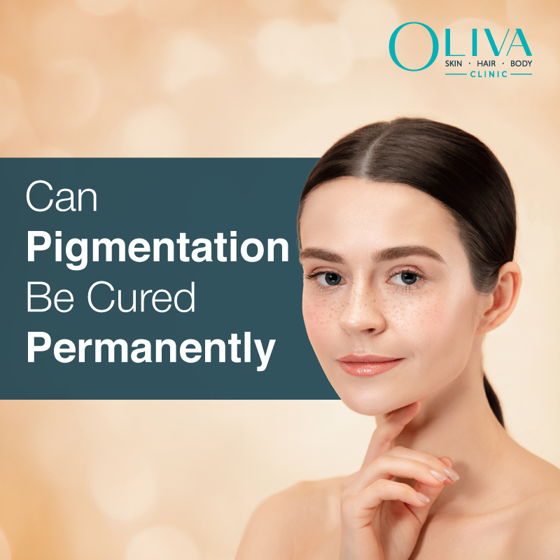 can pigmentation be cured permanently