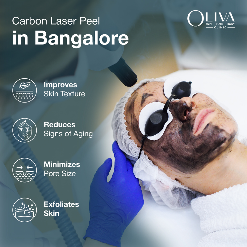 carbon laser treatment in bangalore