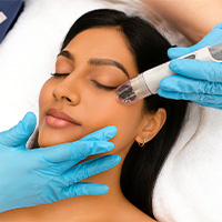 DermaFrac Treatment