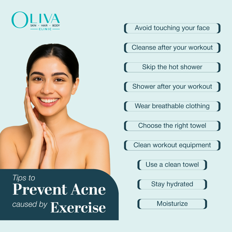 prevent acne caused by exercise