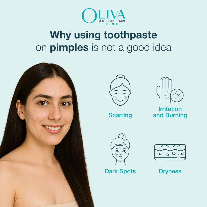 toothpaste on pimple