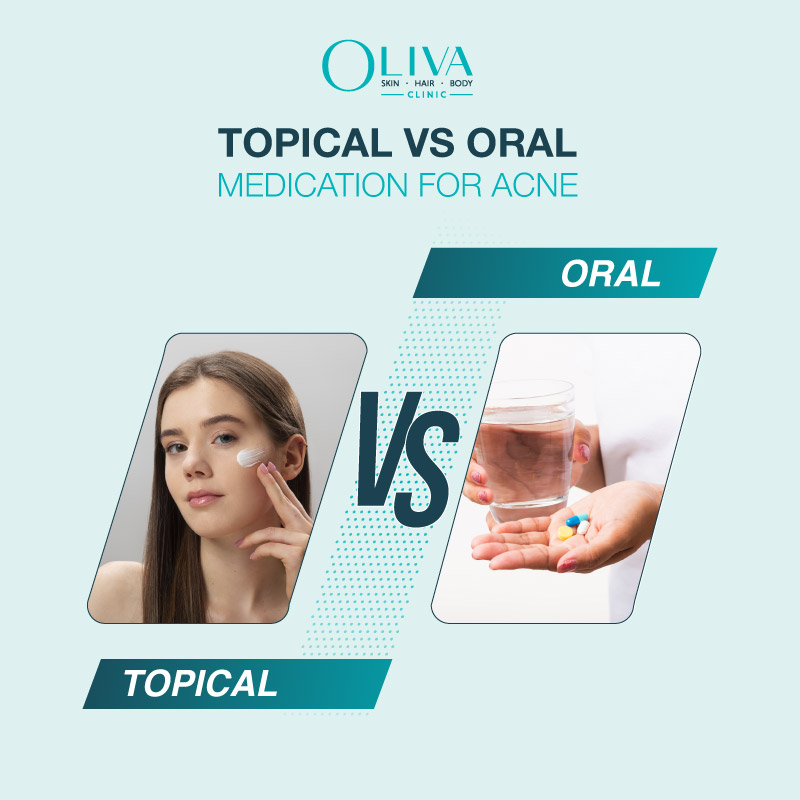 topical vs oral medication for acne