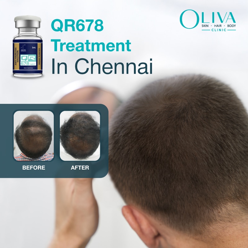 qr678 hair treatment in chennai