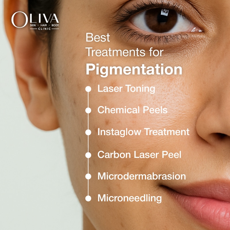 best pigmentation treatments