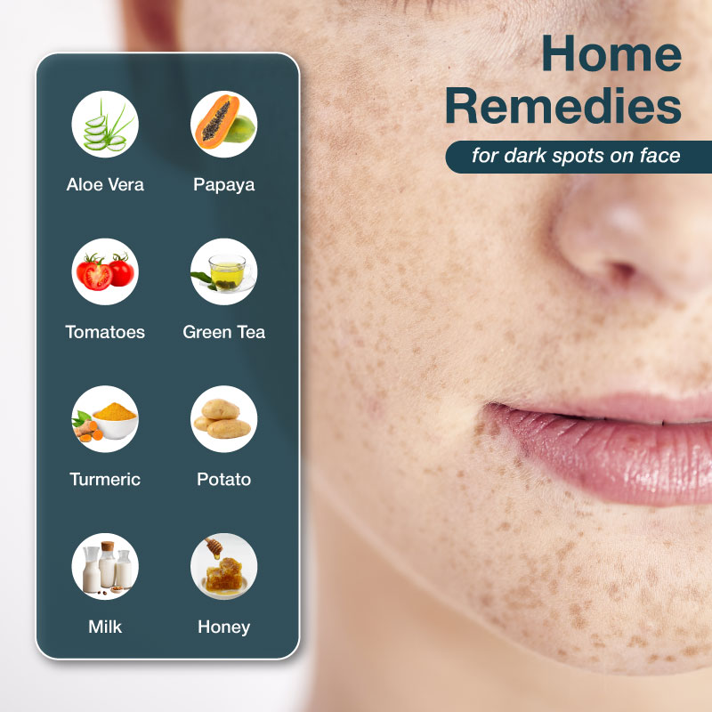 home remedies for dark spots on face