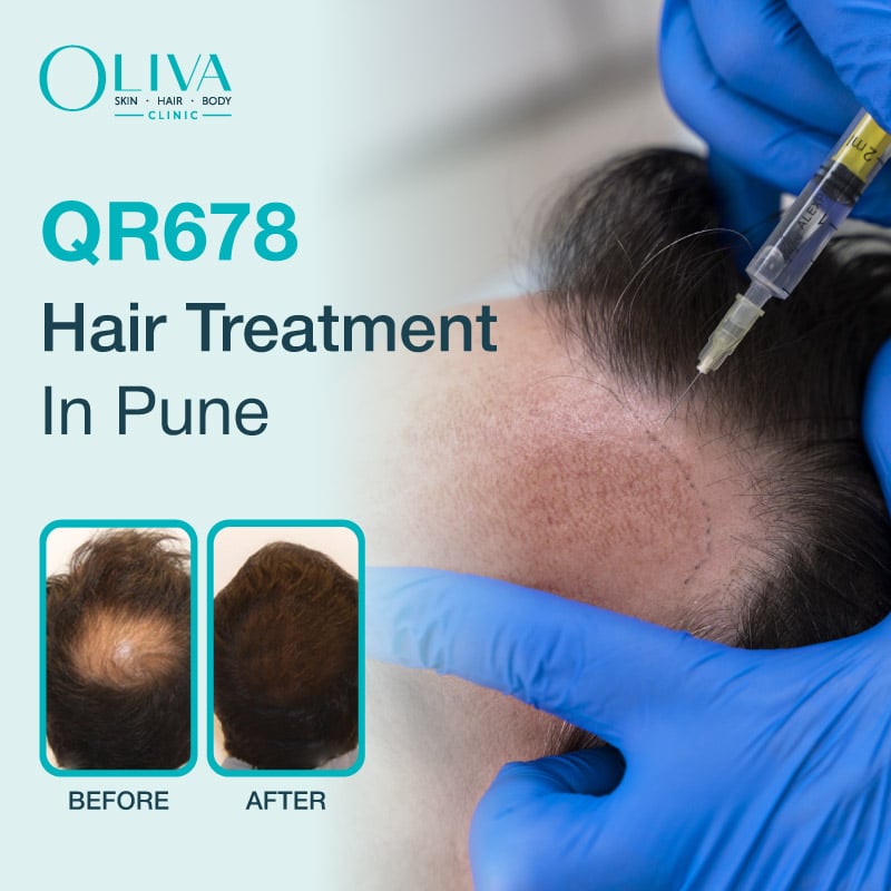 qr678 hair treatment in pune