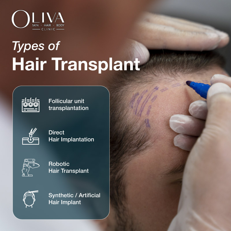 types of hair transplant