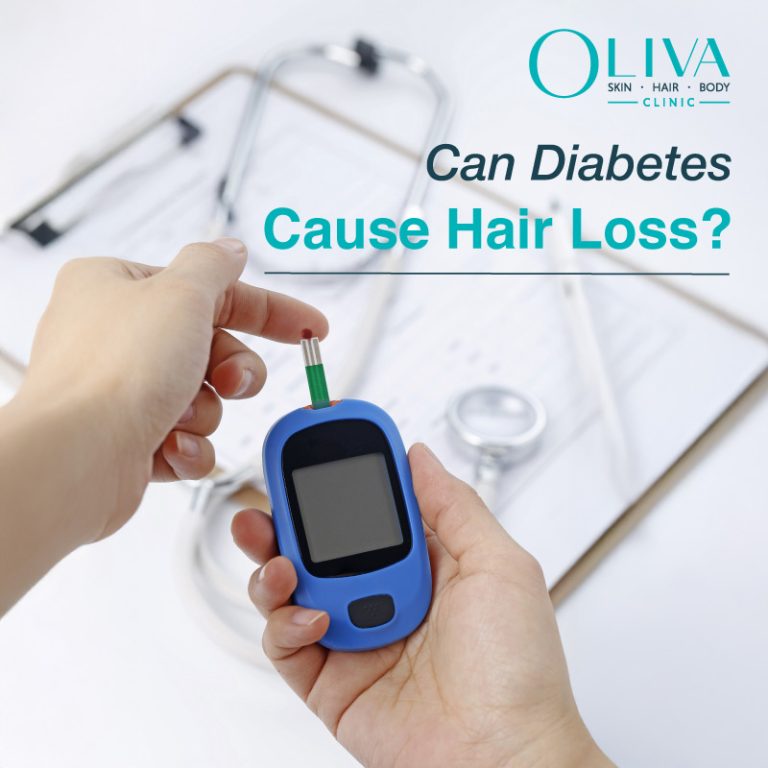 Can Diabetes Cause Hair Loss