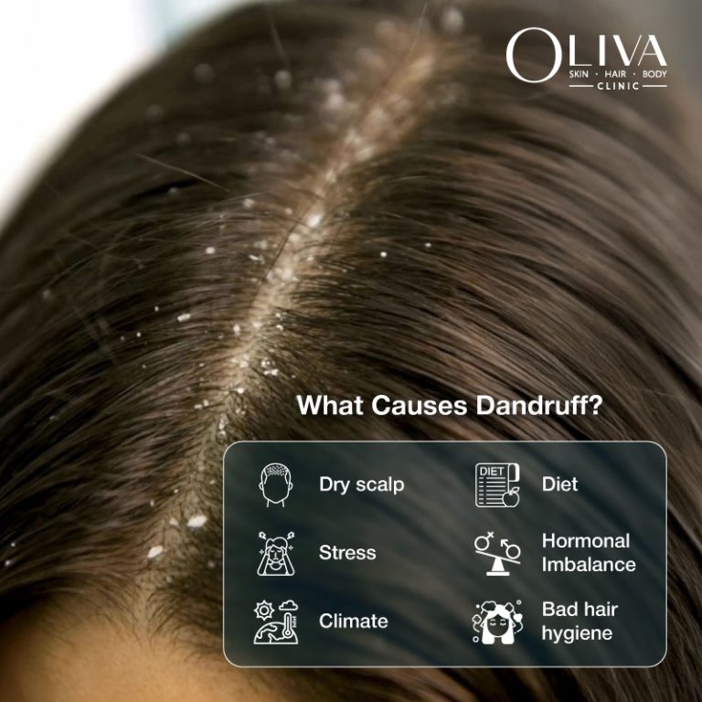 what causes dandruff