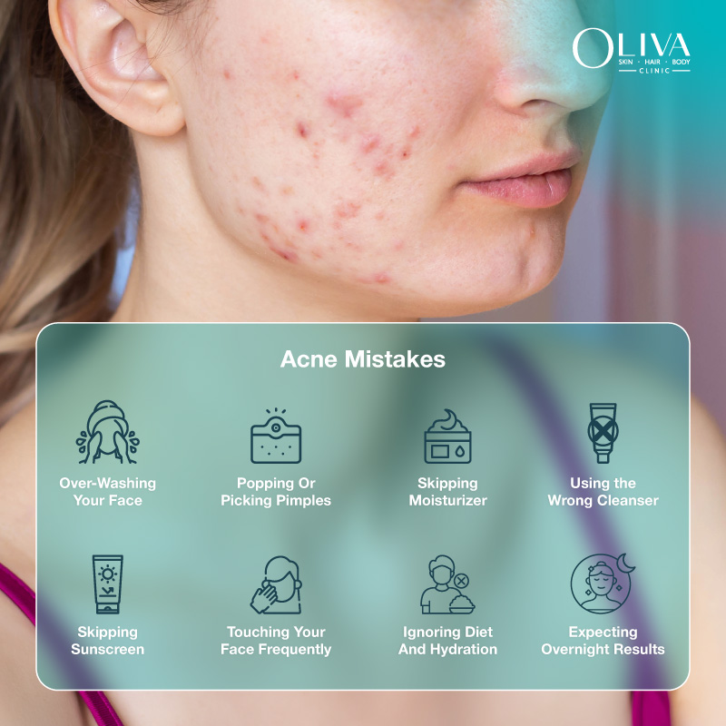 acne mistakes