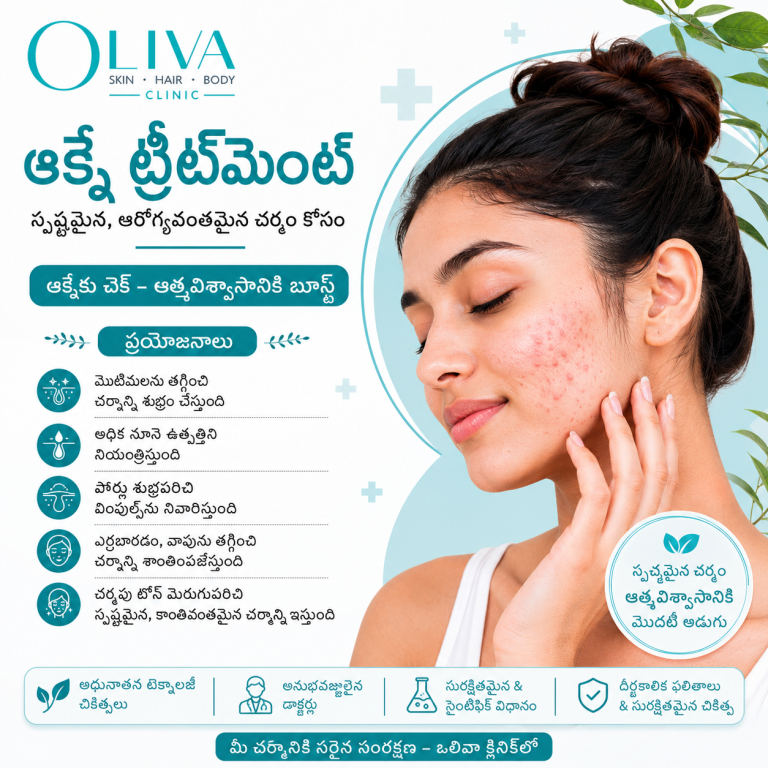 Acne Treatment image